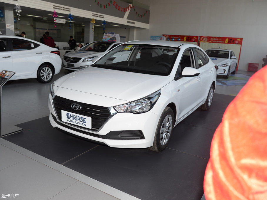 2017{ 1.4L քഺGS