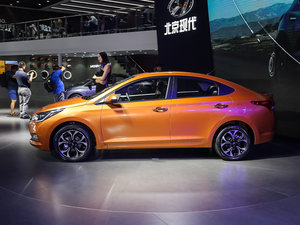 20171.4L ԄӾӢTOP w^