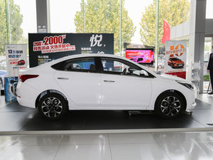 20171.6L ԄӾӢTOP w^