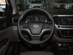 20171.6L ԄӾӢTOP P