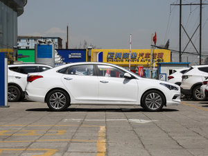 2017款1.8L 自动智能型GLS 国V 整体外观