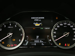 2017370TURBO ҫ V п؅^