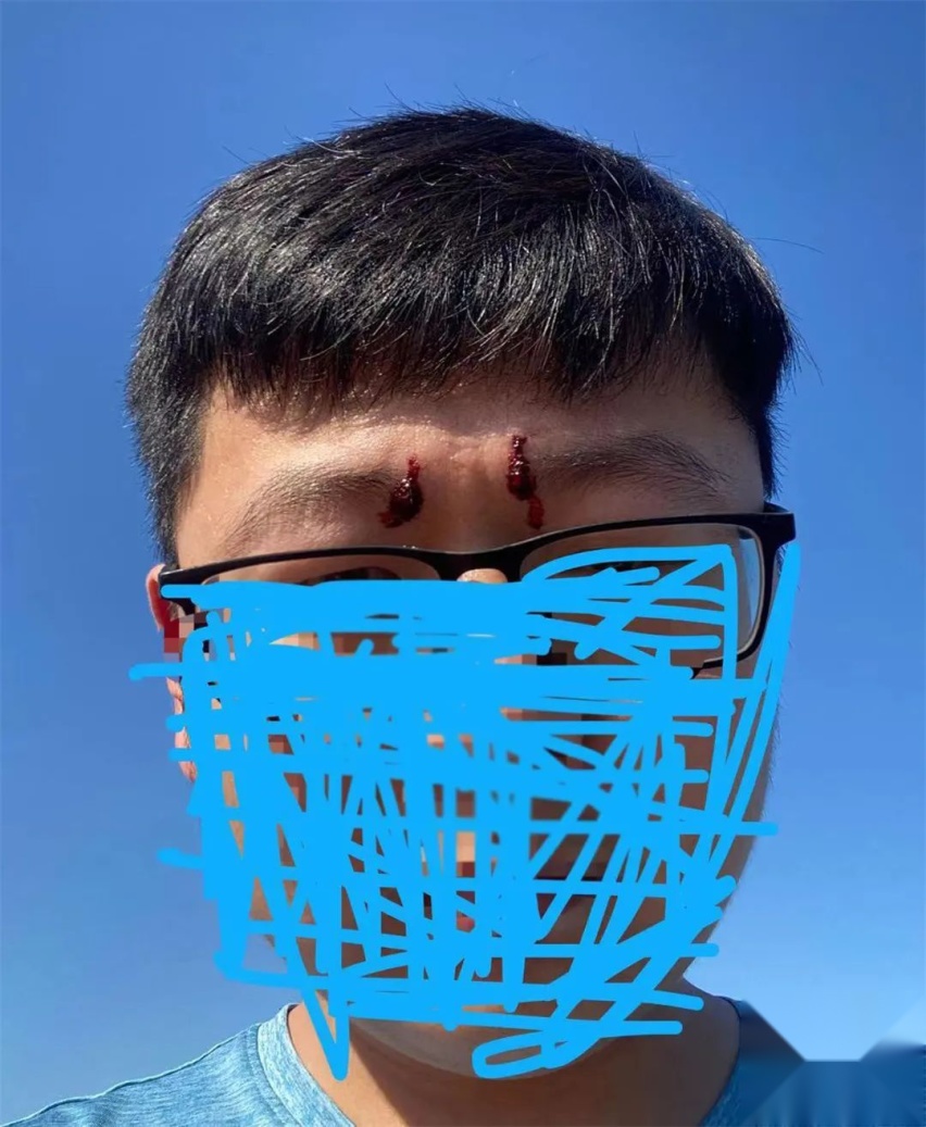 又撞车了，疑似小鹏P7开辅助驾驶追尾大货车，不要再炫耀了