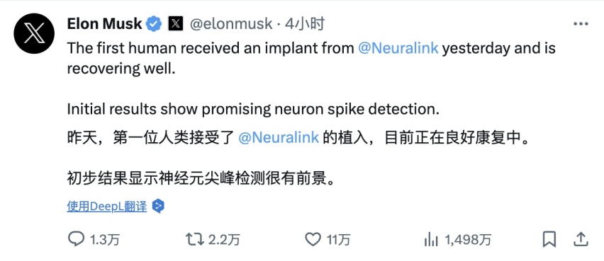 马斯克给人装上了脑机接口