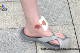 外卖骑手撞伤女子被索赔医疗费却称只有3块钱，事情要如何收场？