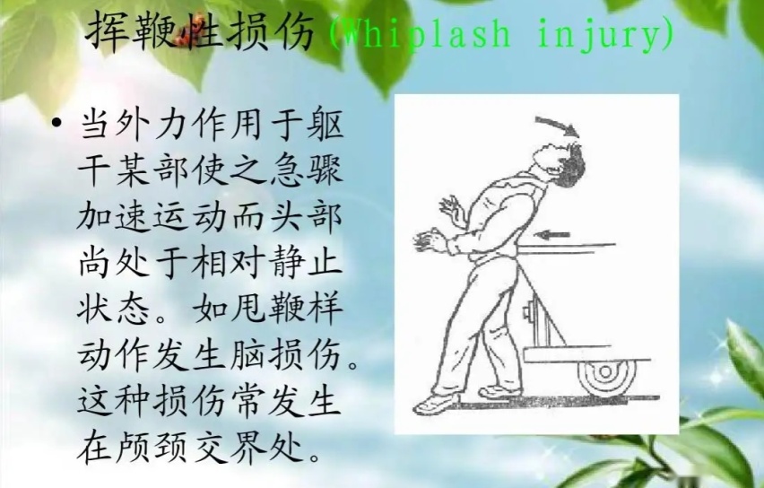 为什么汽车头枕都很不舒服，难道太舒服会影响生命安全？