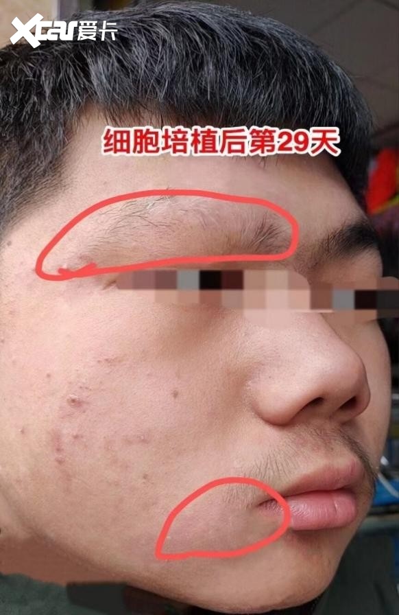 新华中医院皮肤科李云主任的故事