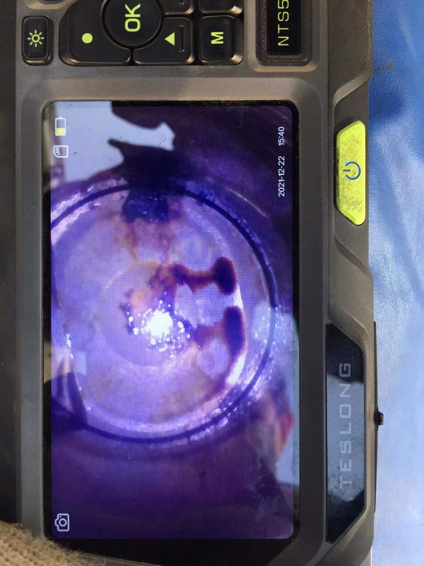 奥迪A6L烧机油不大修，成功解决活塞环卡滞的经验分享