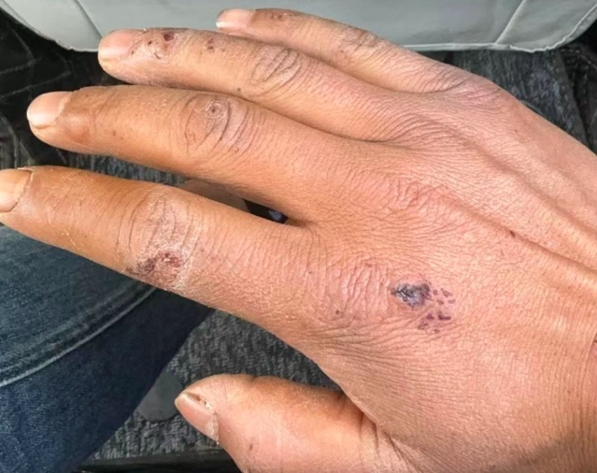 这才是安全的电动车 ！哪吒S滚下90米大坡   车主手擦破一点皮
