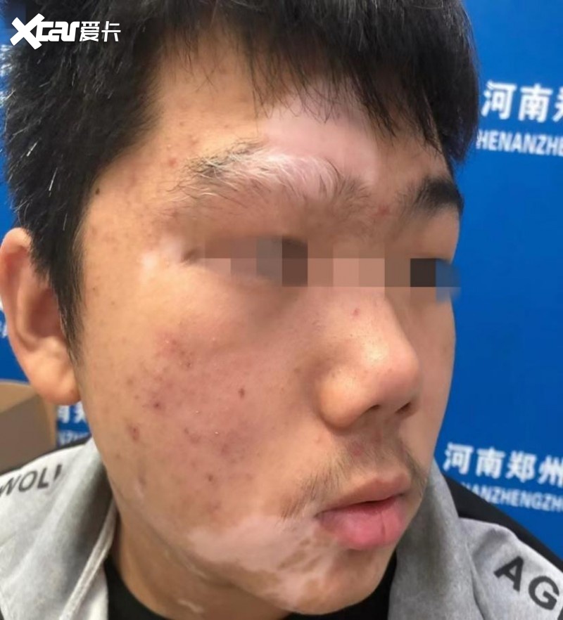 新华中医院皮肤科李云主任的故事